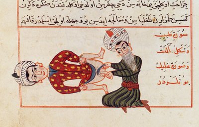 Ms Sup Turc 693 fol.76v Operazione di castrazione, 1466 da Charaf ed Din